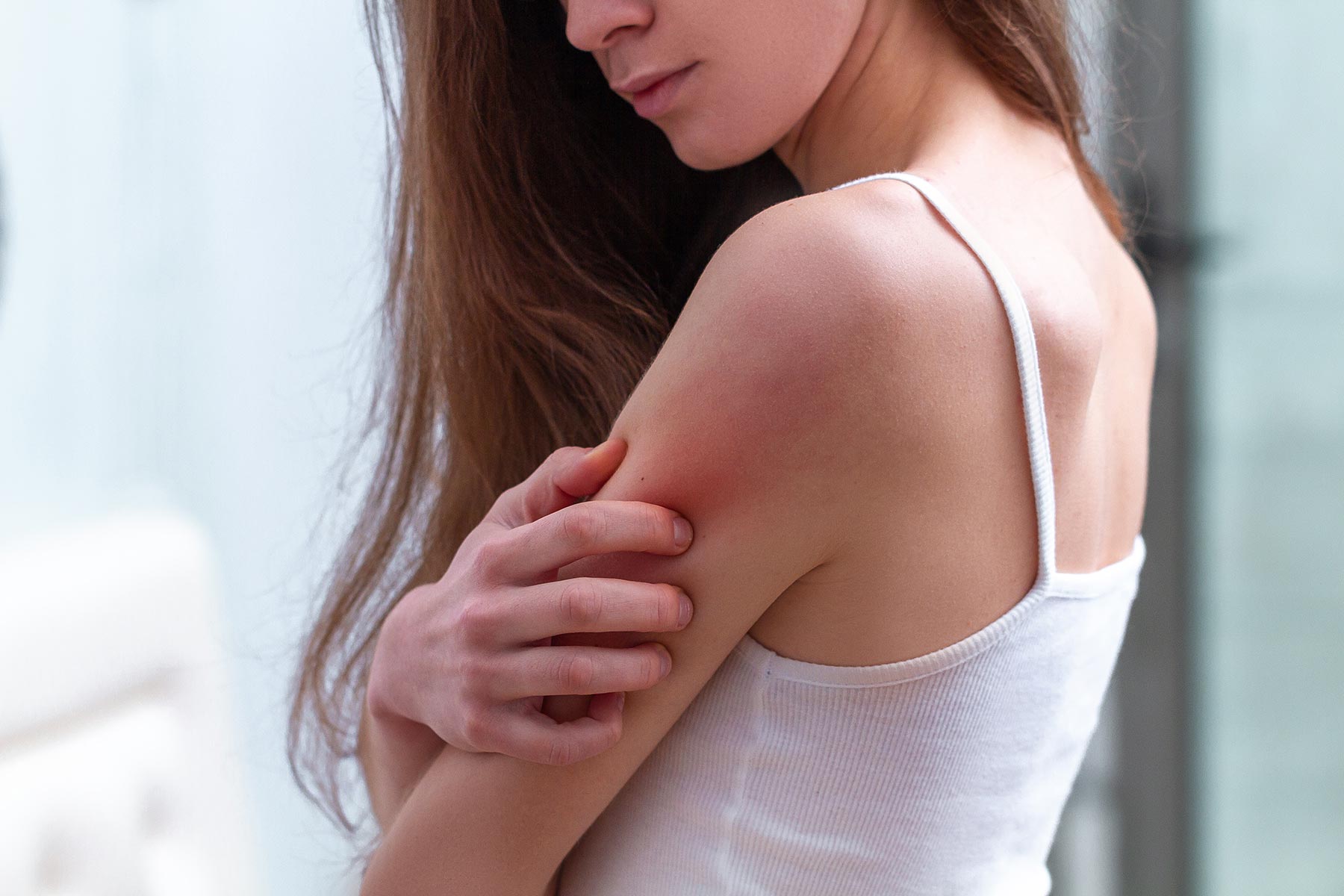 Eczema.... What Are the Best Anti-Aging Products for Eczema?