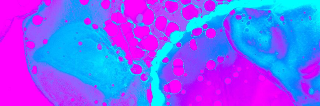 Are Amino Acids Really Acids?