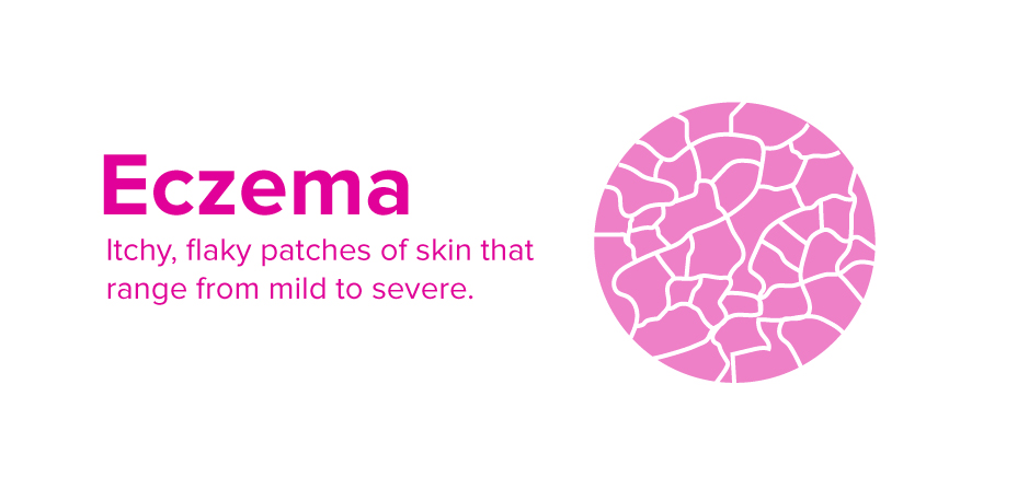 Is Cold Weather Worsening Your Eczema? 1 eczema