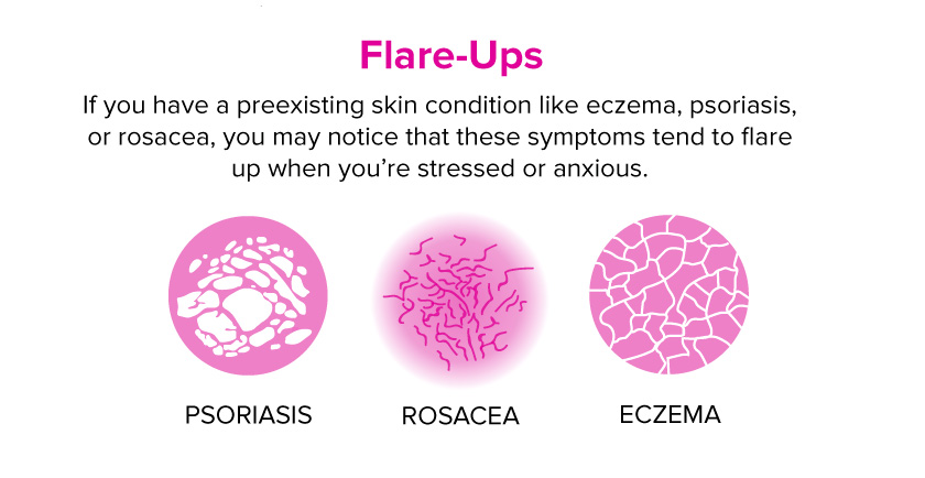What Happens to Your Skin When You’re Stressed or Anxious? 2 flareups 1