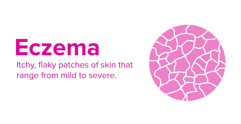 Is Cold Weather Worsening Your Eczema? 1 ecz